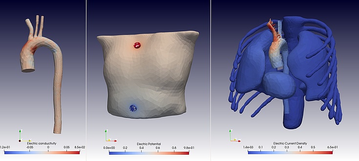 Three computer images side by side: on the left an aorta, in the centre an upper body with electrodes on top and bottom, and the inside of the human upper body with aorta, organs and ribs.