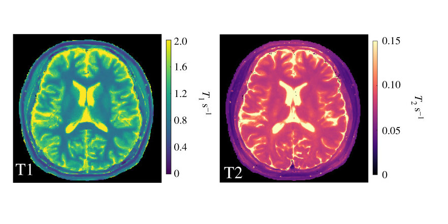 Brain visualisation